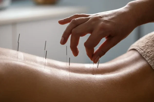 acupuncture clinic acupuncture clinic