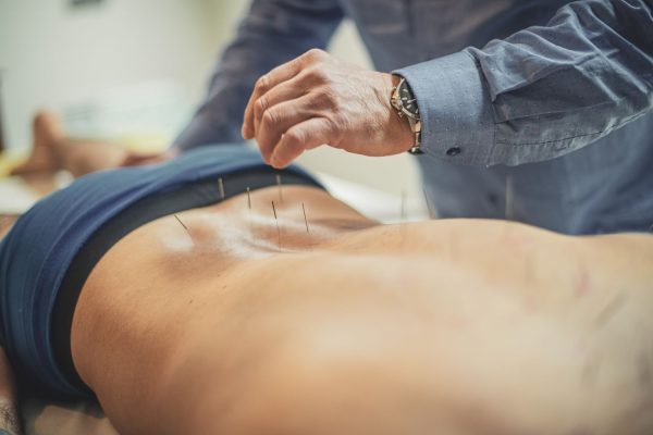 acupuncture therapy acupuncture therapy